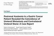 Postrenal Azotemia in a Gastric Cancer Patient Revealed the Coincidence of Ureteral Metastasis and Contralateral Ureteral Stone: A Case Report